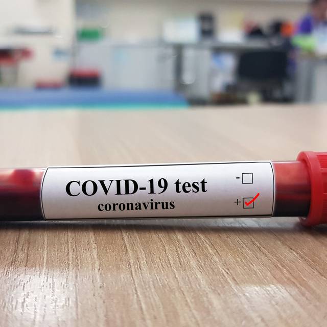 Corona Virus Bluttest