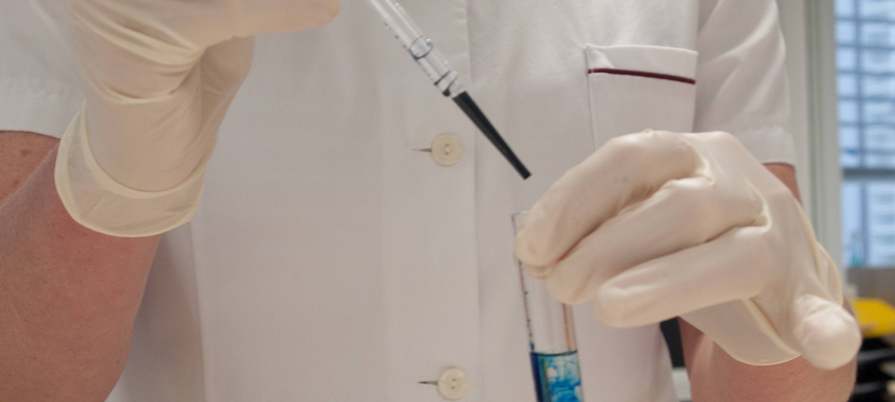 Untersuchung auf Blaualgen