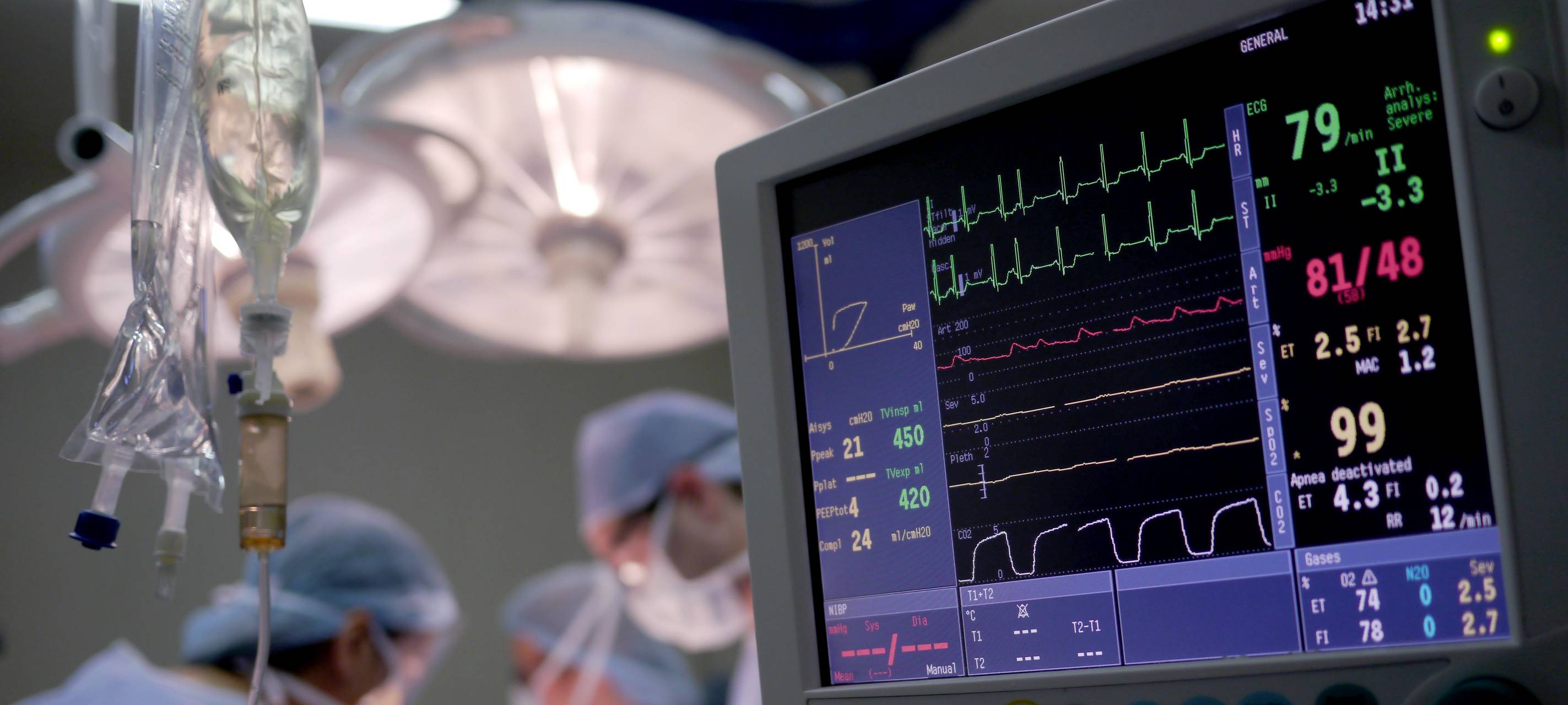 Herz-Kreislauf-Erkrankungen häufigste Ursache für Krankenhausaufenthalte in Bochum