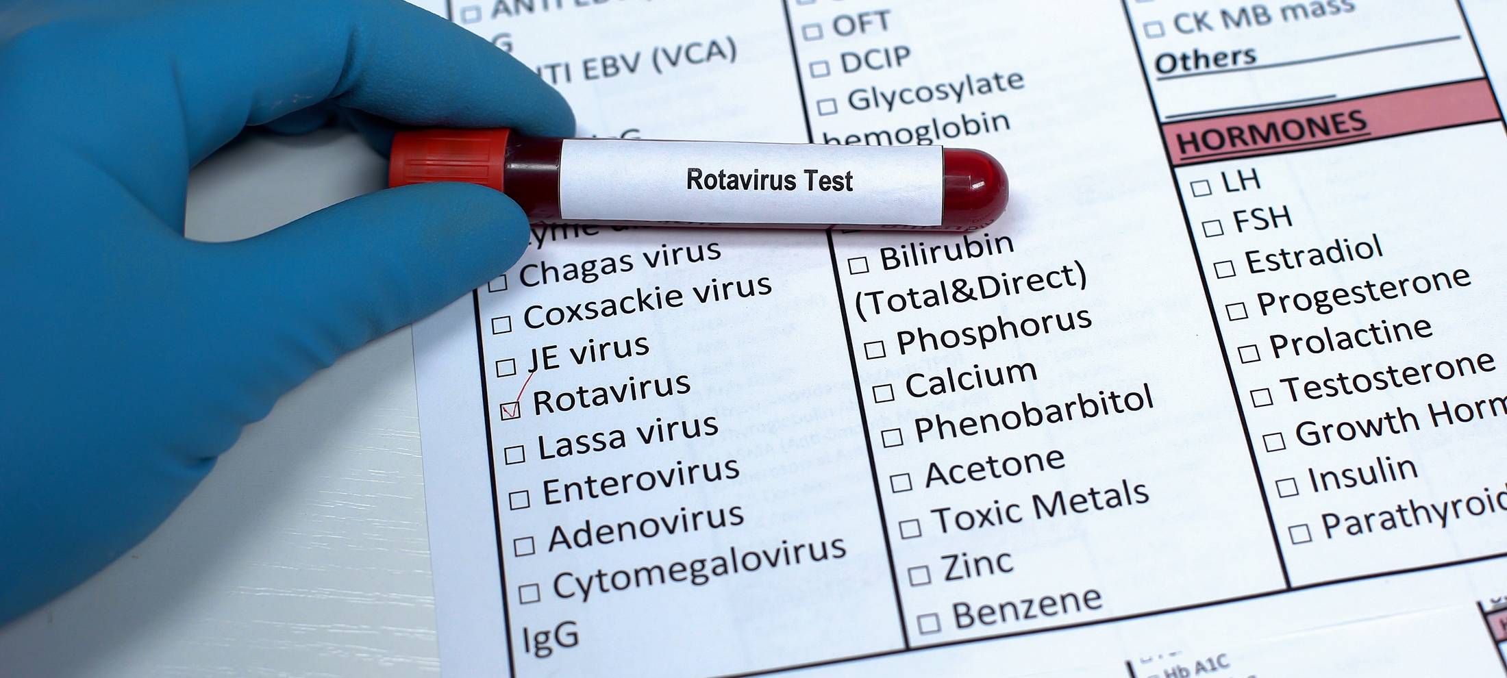Mehr Rotavirus-Fälle in Bochum