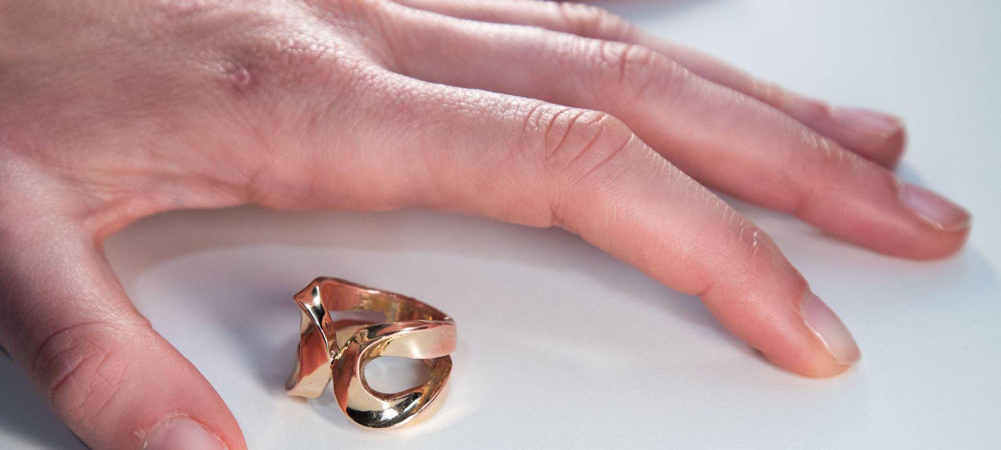 Ein Ring liegt neben der Hand einer Frau